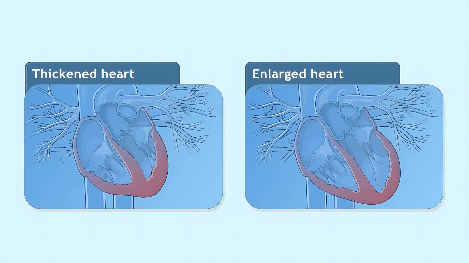 Common Aortic Valve Problems: Overview