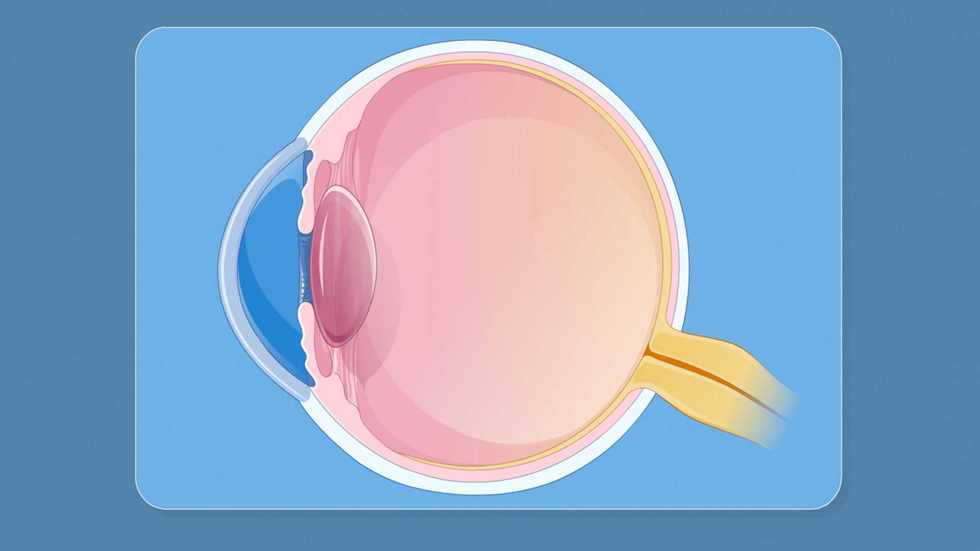 LASIK Eye Surgery: Risks